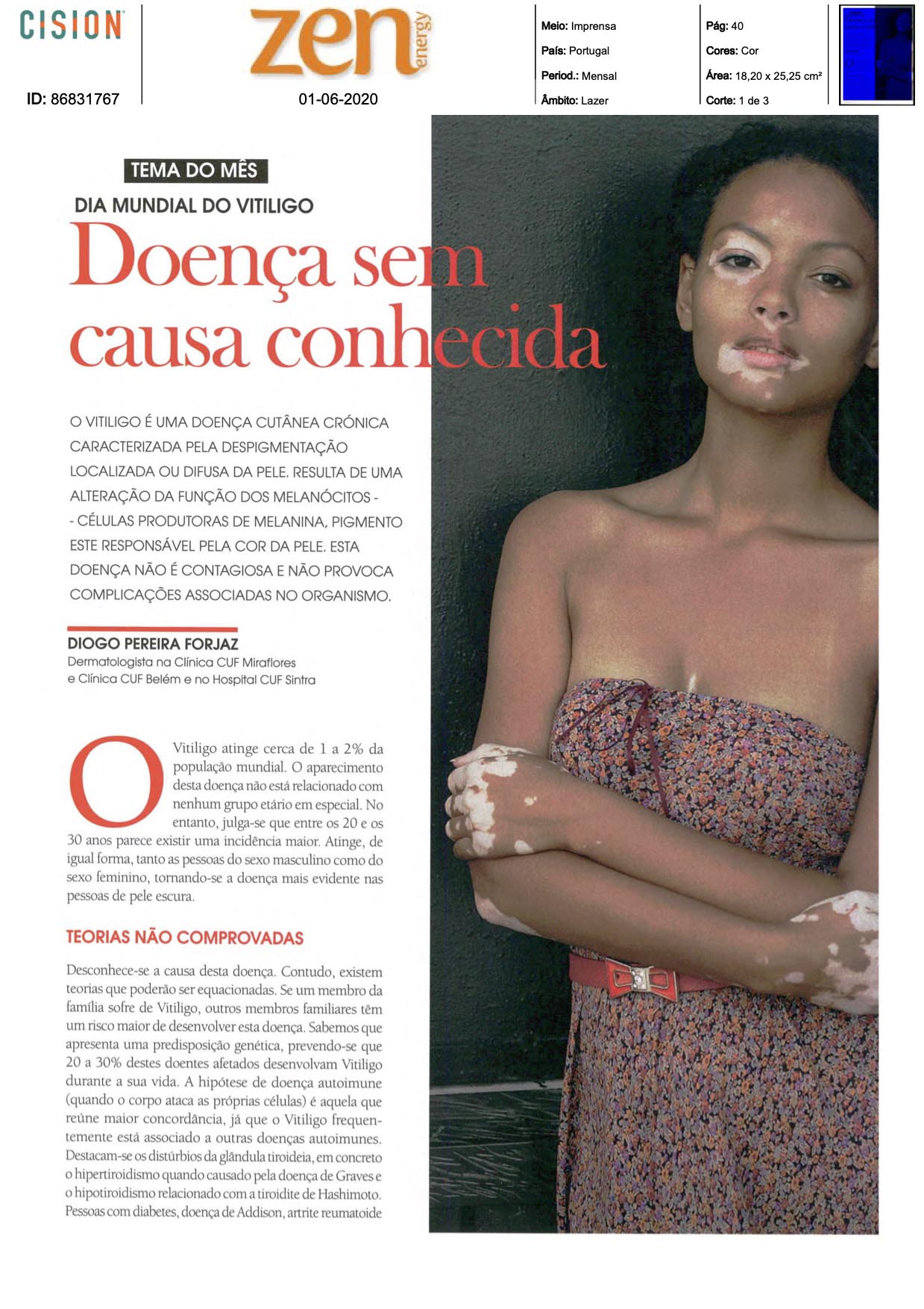 clinica-forjaz-vitiligo1